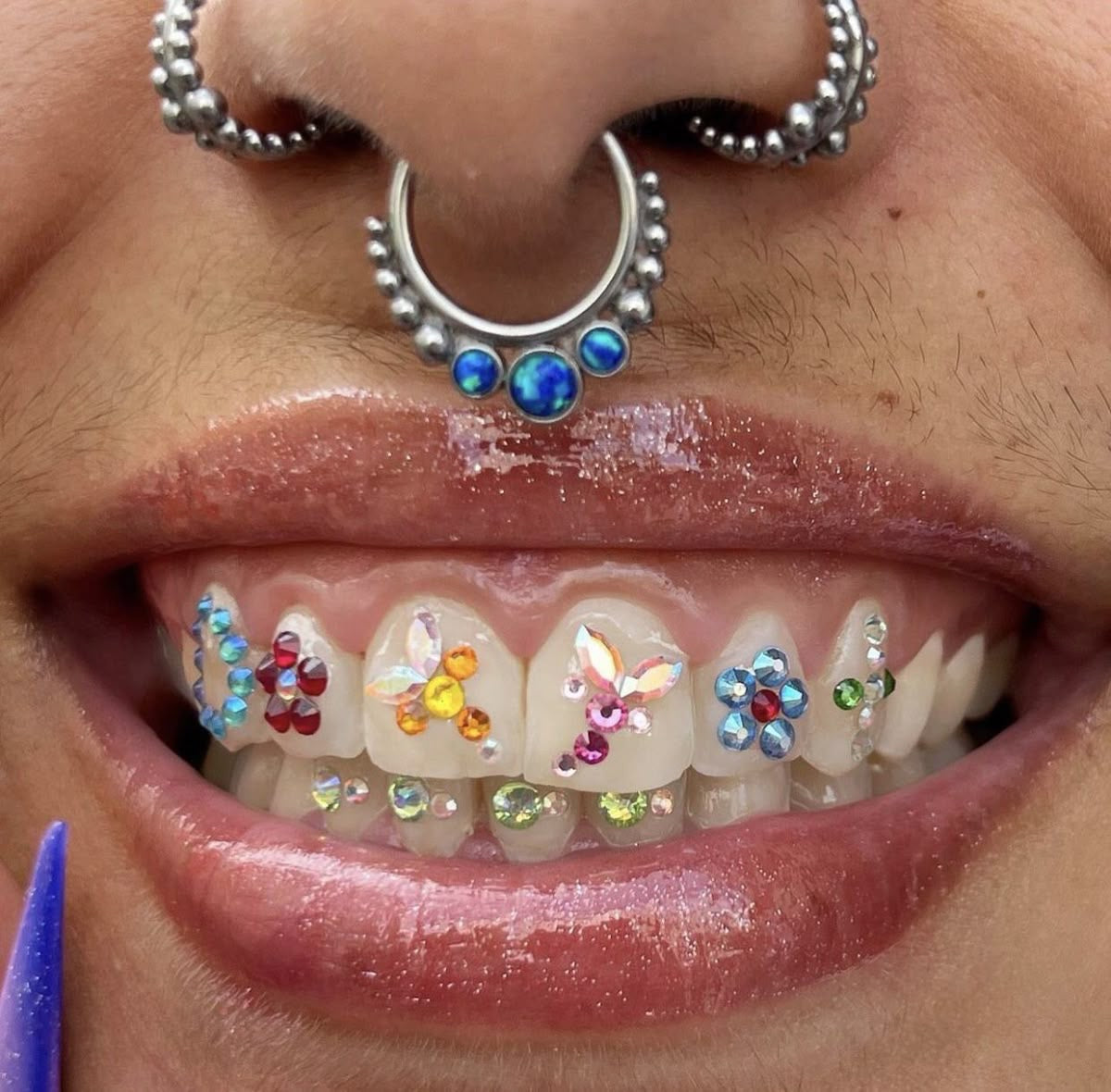 Tooth Gems 3 Steine